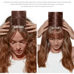 Bain Crème Anti-pelliculaire Symbiose Kérastase 250ML -Hair Care Soldes bain creme anti pelliculaire symbiose kerastase 250ml 2