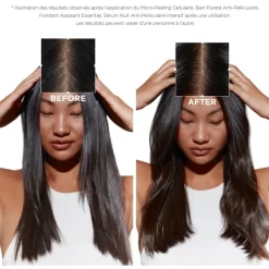 Micro-peeling Cellulaire Symbiose Kérastase 200ML -Hair Care Soldes micro peeling cellulaire symbiose kerastase 200ml 2